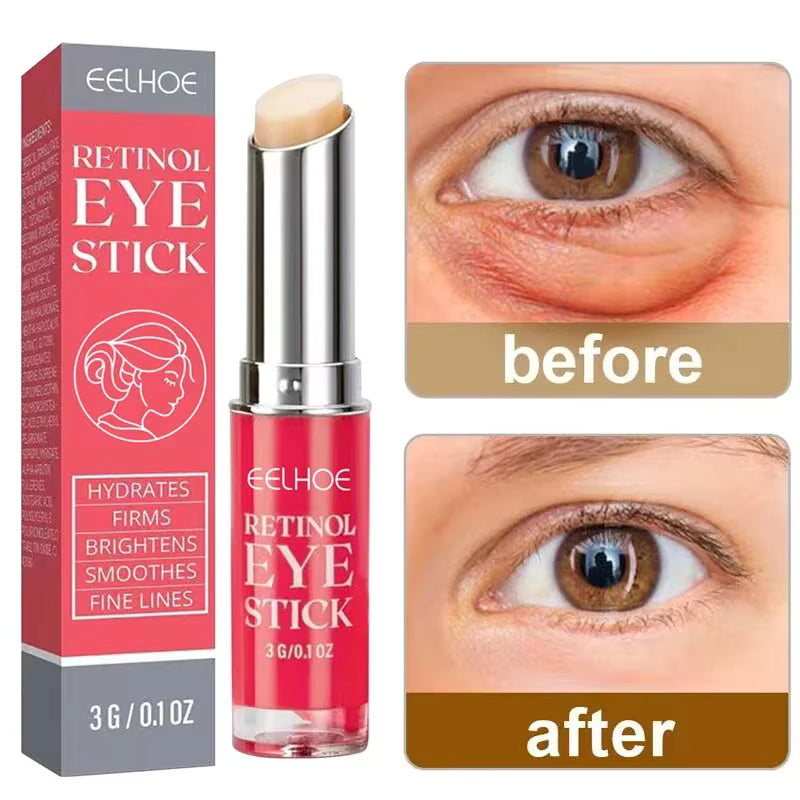 Anti-Wrinkle Retinol Eye Cream